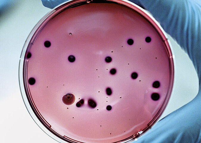 Petri dish for microbiological food analysis